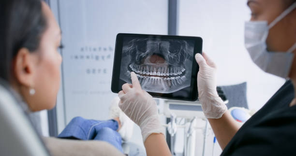 Licensed Teeth Whitening service in Meadowlakes, TX - Smile Center Dentistry